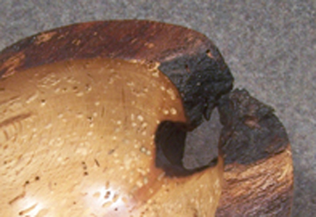 Buche-alt-naturrand-01.gr